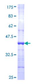 SDS-PAGE (CSF3R-1975H).jpg